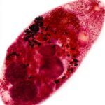 Medical Parasitology Atlas Kindle Edition English Print-0