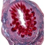 Medical Parasitology Atlas Kindle Edition English Print-0