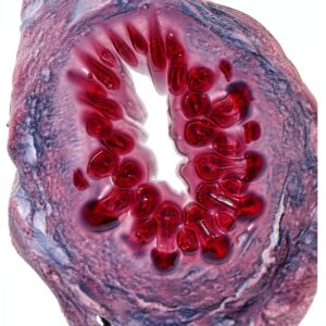 Medical Parasitology Atlas Kindle Edition English Print-0